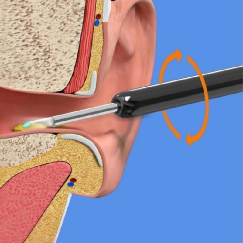 Ear wax removal tool Suitable for Android iOS phones